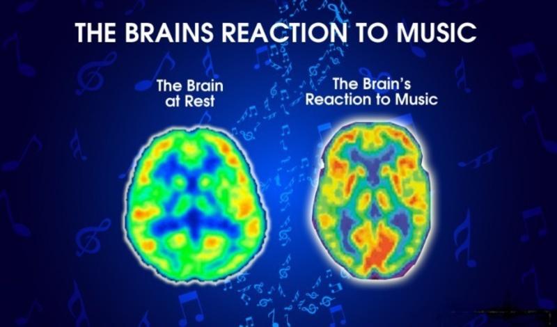 Âm nhạc rất tốt cho sự phát triển của não bộ